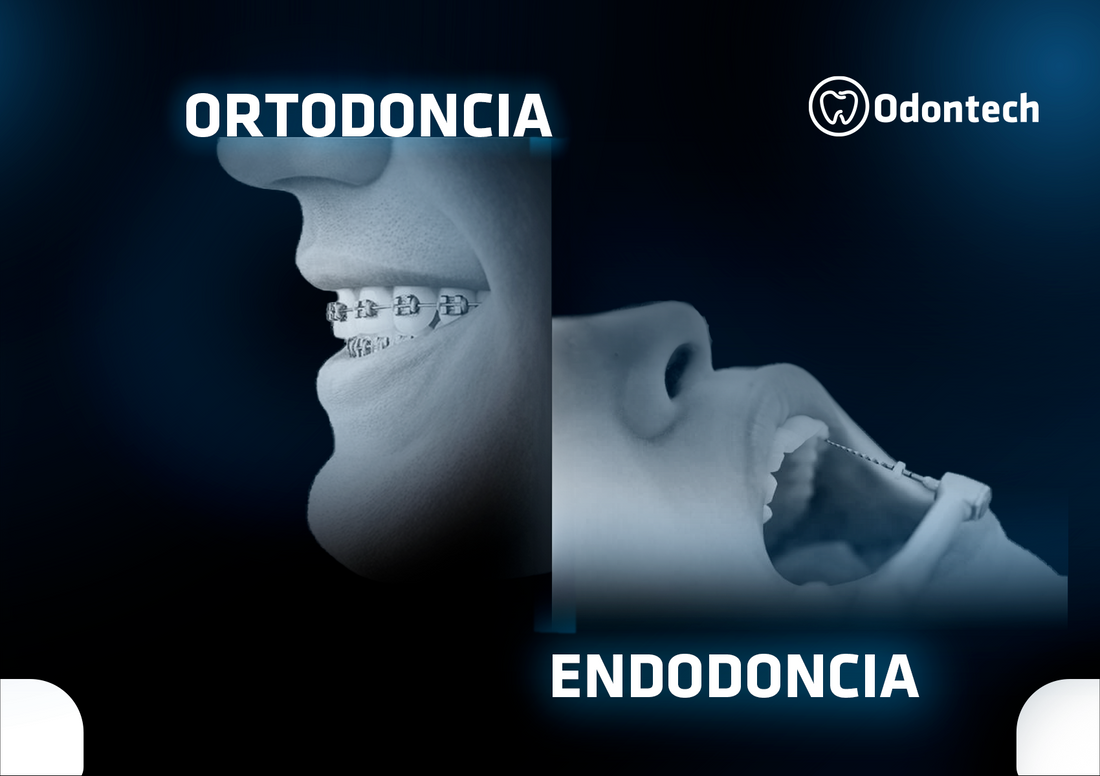 Brackets de Alto Valor de Ortho Organizer: Innovación en Ortodoncia